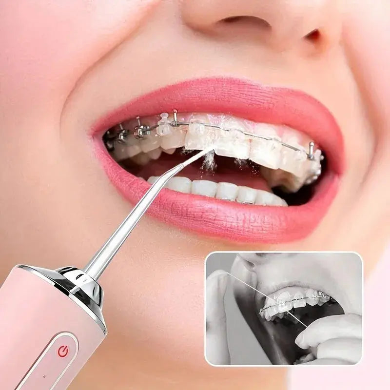 USB Portable Oral Irrigator Water Flosser Dental Water Jet Tools Pick Cleaning Teeth 200ML 4 Nozzles Mouth Oral Cleaning Agents TecnoValet